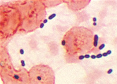 What is Enterococcus faecium?