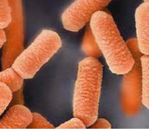 Lactobacillus johnsonii LBJ 456 Lactobacillus johnsonii LBJ 456