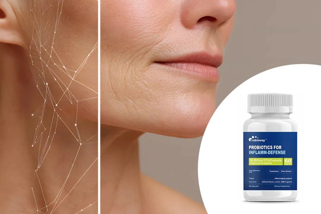 PROBIOTICS FORINFLAMM-DEFENSE PROBIOTICS FORINFLAMM-DEFENSE